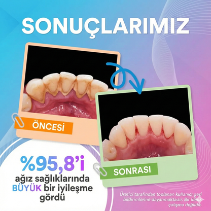 Smiletherapy Ağız Duşu